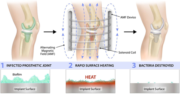 Solenic Knee